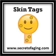 Serum for Lines by Secret of Aging makes Skin Tags disappear quickly